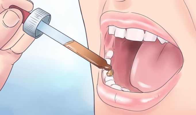 diş ağrısı tedavi yöntemleri