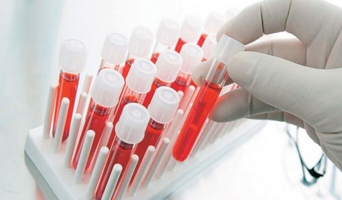 Kansızlık tedavisi