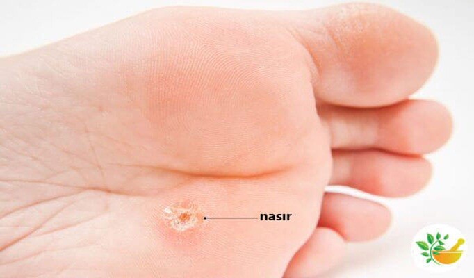 Nasır nasıl geçer