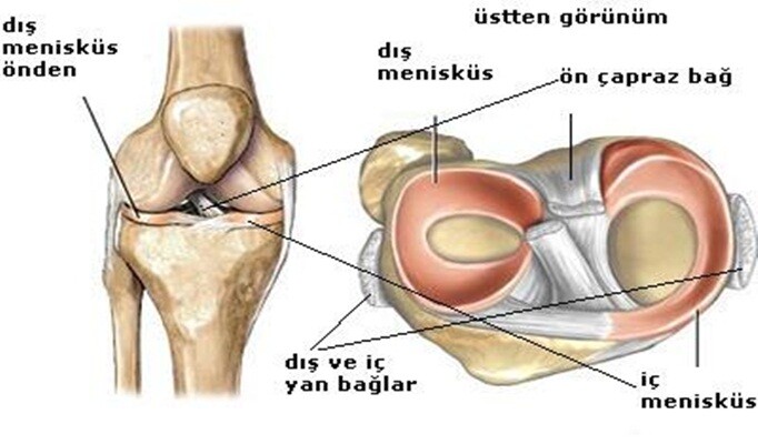 Menisküs yırtığı tedavisi