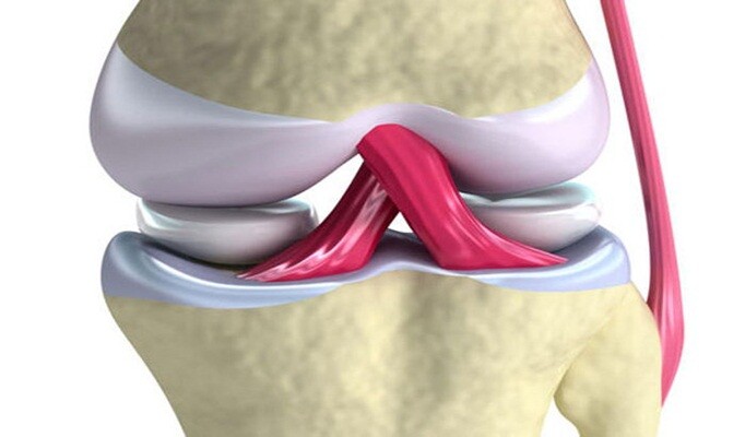 Menisküs yırtığı